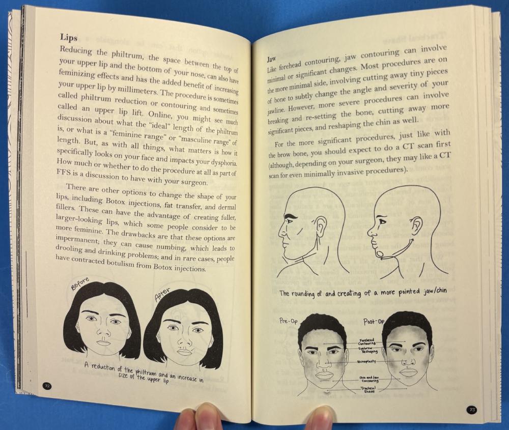 The Transfeminine Guide to Physical Transition: For Trans, Nonbinary, and Other Feminine Folks by Amelia Simone Hanrahan